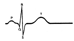Нормальная электрокардиограмма – ЭКГ