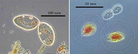 Haemotococcus pluvialis