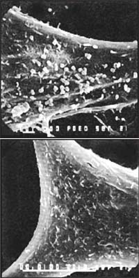 Рис. 5. Нанобы, облепившие фибробласт (внизу – контроль)