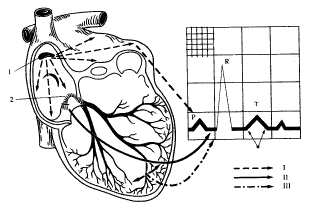 Схематическое изображение связи между участками возбуждения сердечной мышцы и отдельными зубцами электрокардиограммы