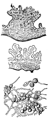 Развитие таллома у лишайников