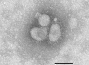 Рис. 2. Вирус SARS (негативное контрастирование); линейка – 100 нм