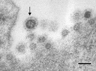 Рис. 3. Вирионы SARS вне клетки. Стрелкой отмечен классический образец с оболочкой; линейка – 100 нм