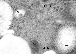 Рис. 4. Скопления (везикулы), содержащие вирусы SARS; простой стрелкой указан отдельный вирус вне везикулы; линейка – 100 нм