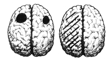 У женщин речевые центры локализованы в обоих полушариях. У мужчин за речь отвечает только одно полушарие – левое
