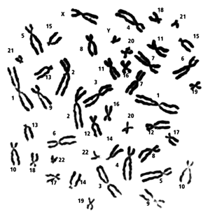Хромосомный набор человека