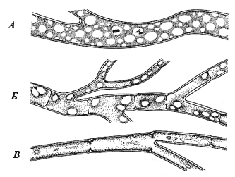 Вегетативные гифы грибов: А — без поперечных перегородок (несептированные); Б — с перегородками (септированные); В — с неполными перетяжками
